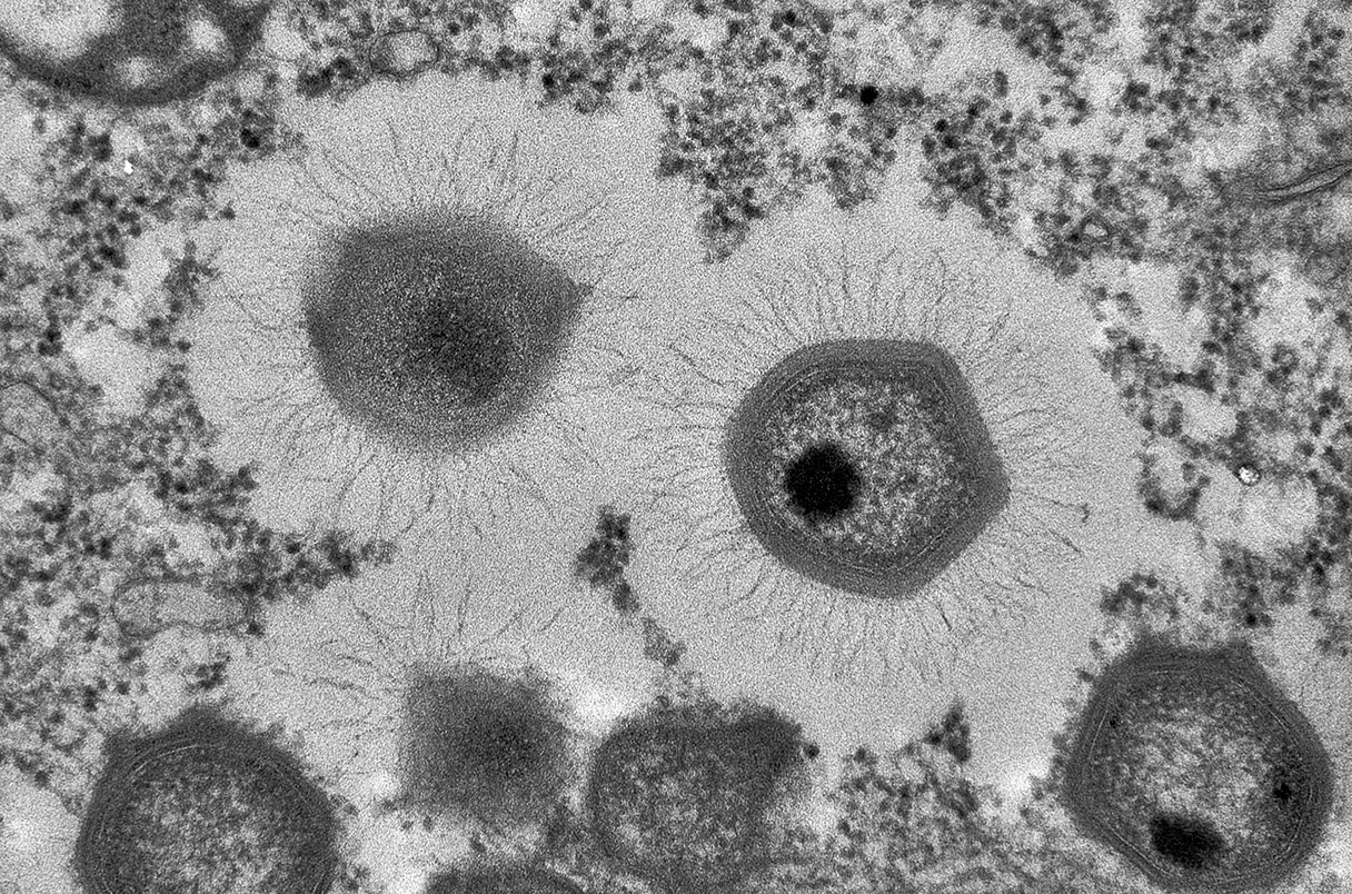 Transmission electron microscopy (TEM) micrograph of a mimivirus particle. Max Fels, DFCI.
