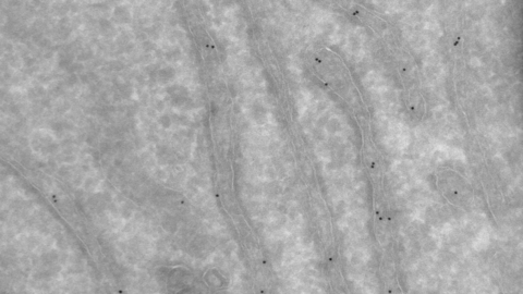 Immunogold Labeled Endoplasmic reticulum 