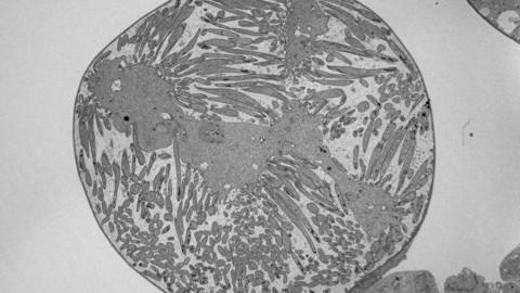 Oocysts TEM