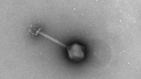 Negative Stained Bacteria Phage