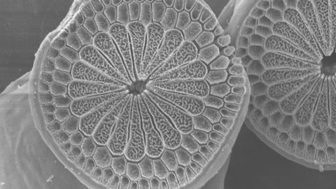 SEM of Squid Tentacle Sucker