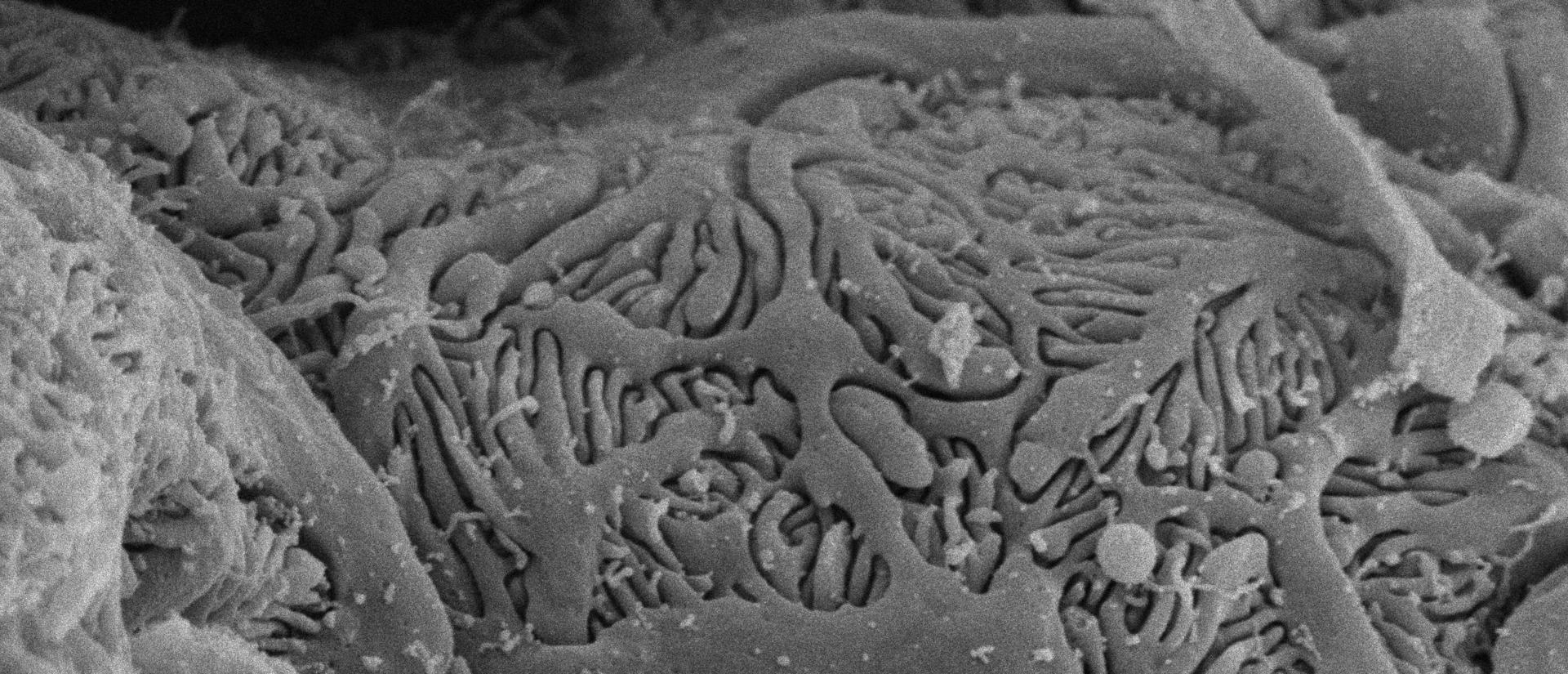 Kidney Glomerulus SEM