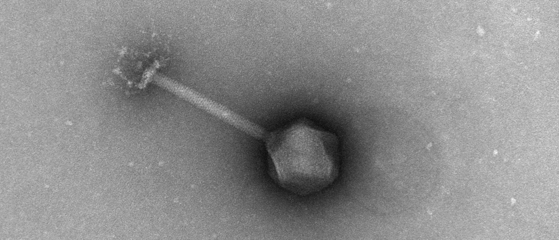 Negative Stained Bacteria Phage