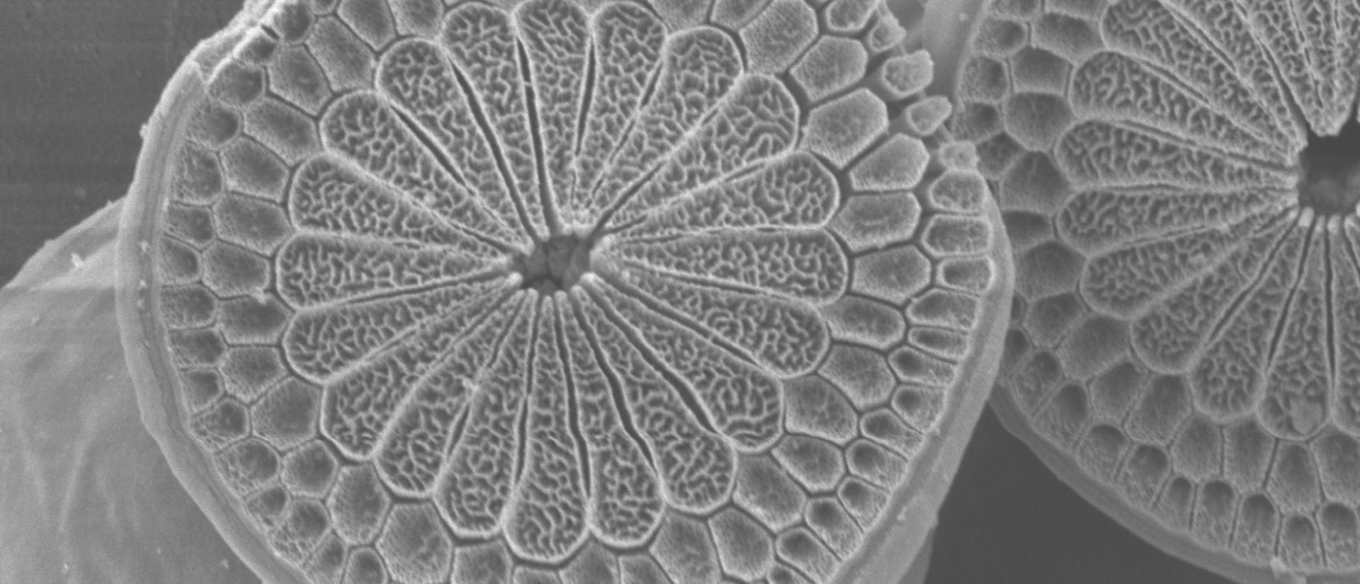 SEM of Squid Tentacle Sucker