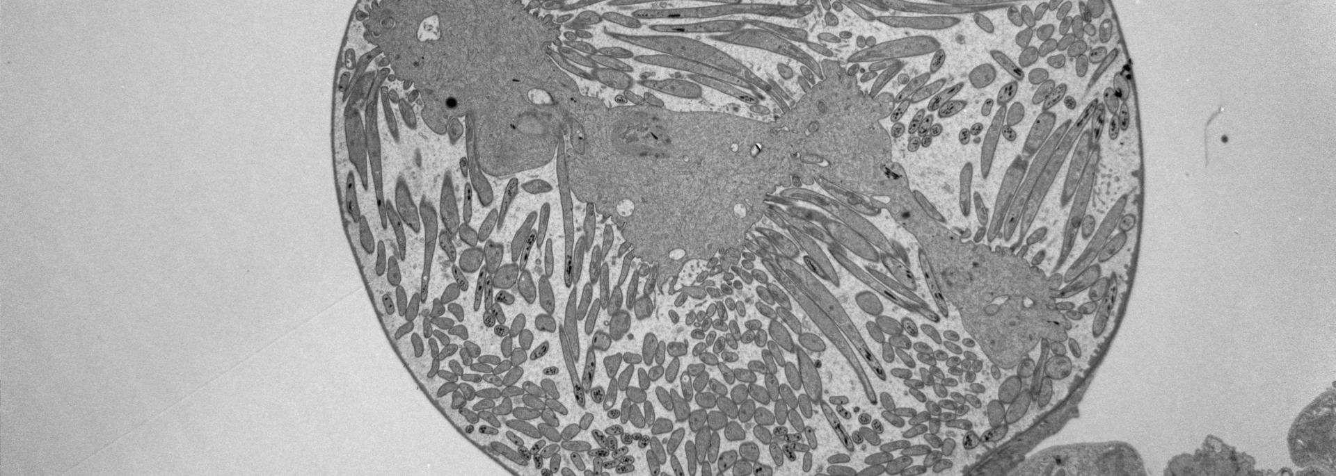 Oocysts TEM
